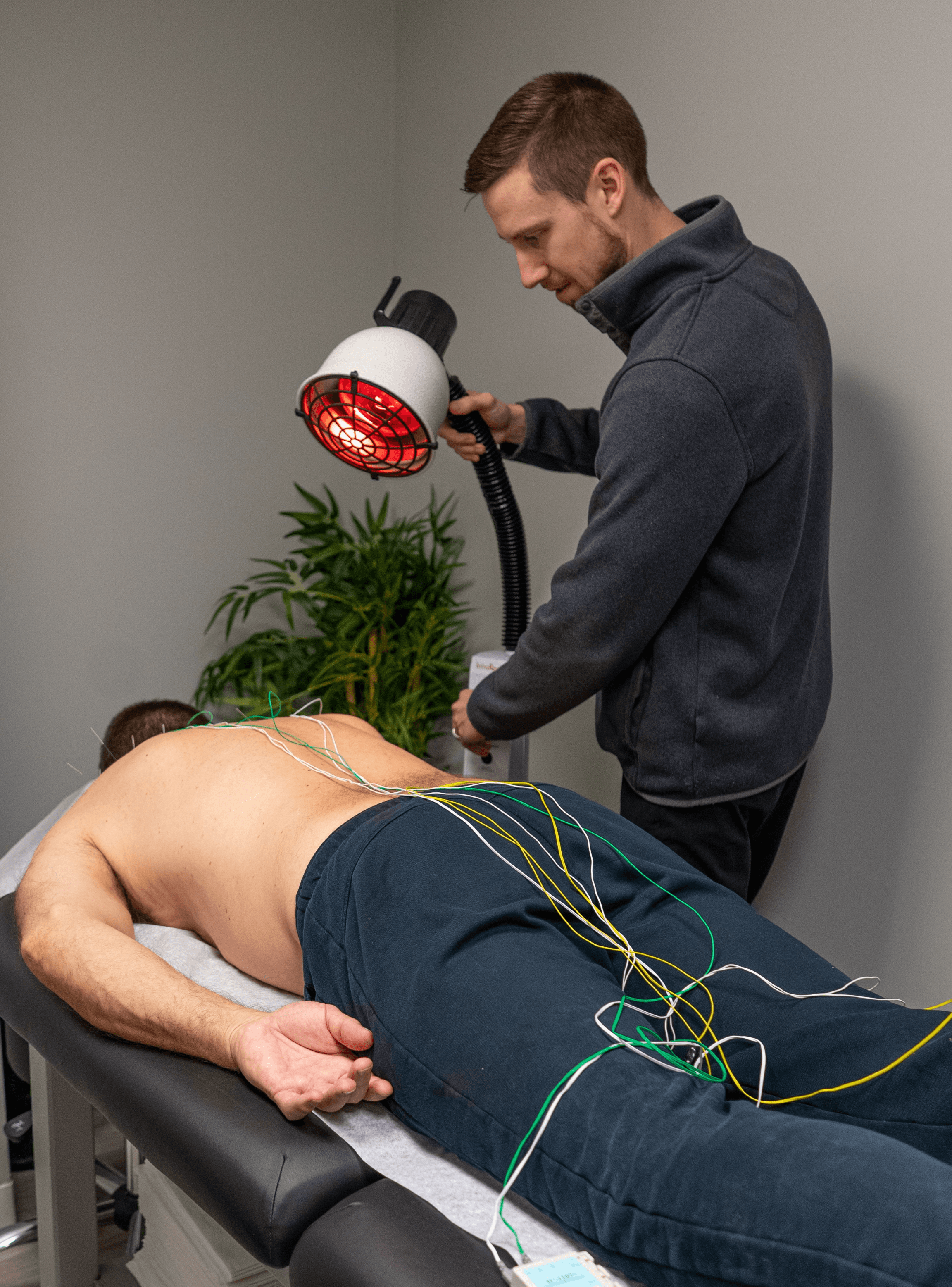 Acupuncture