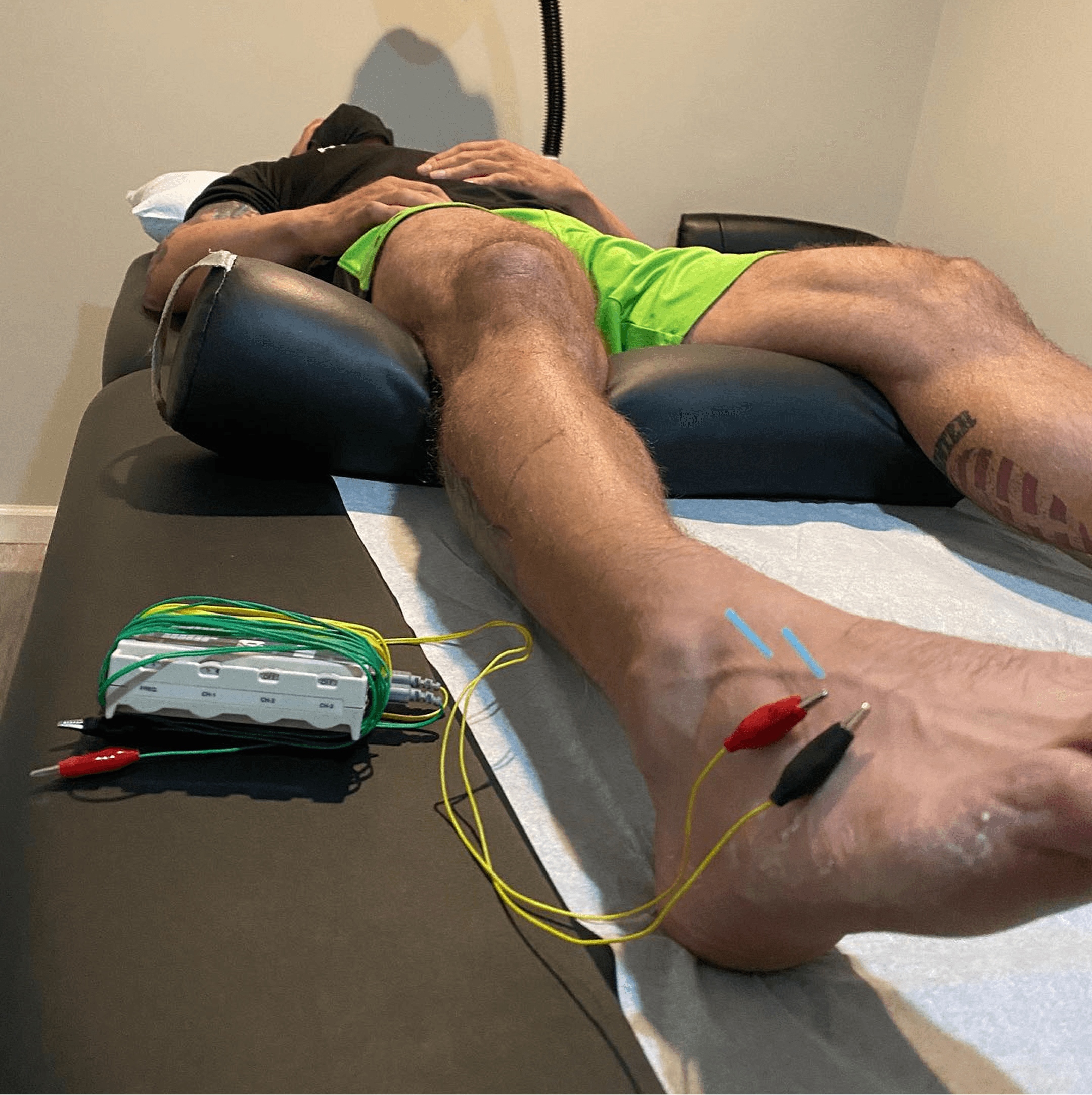 Patient receiving electro-acupuncture on the ankle at Thrive Freehold, with leads clipped to the needles