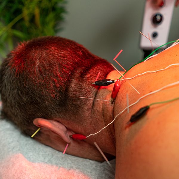 Acupuncture therapy for neck pain freehold, nj